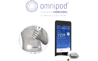 SDRI Plays Pivotal Role in FDA Clearance of Omnipod 5 System